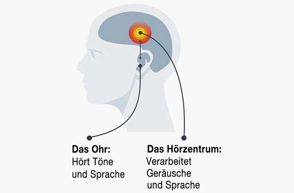 Audiosus - einfach besser hören